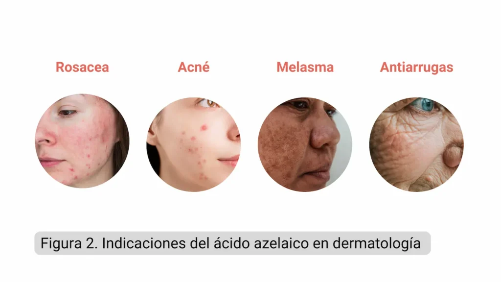 acido azelaico dermalogica beneficios y uso